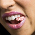 Troppi chewing gum causano emicrania