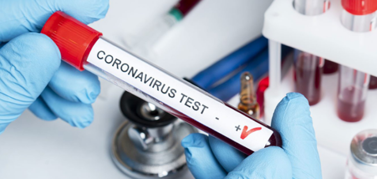Malumori nella sede Nestlé di Wangen per il bonus in cambio del test anti COVID